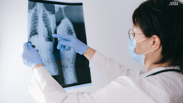 Tips Rahasia Dokter Cara Menjaga Paru-Paru Tetap Sehat